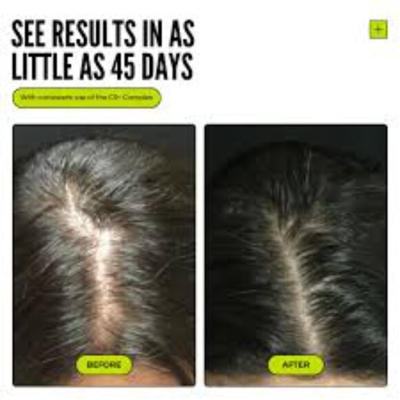 Clean Slate Thickening Hair Growth Combo , ( 59ml X 2 ) - Picture 2 of 6